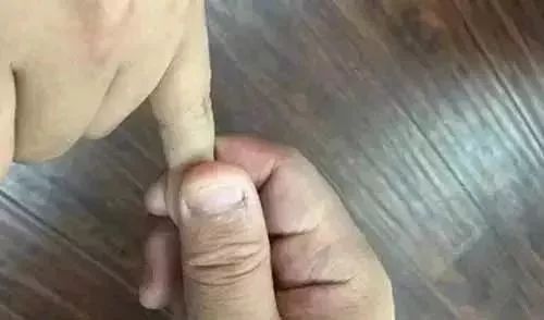 推拿95指的什么